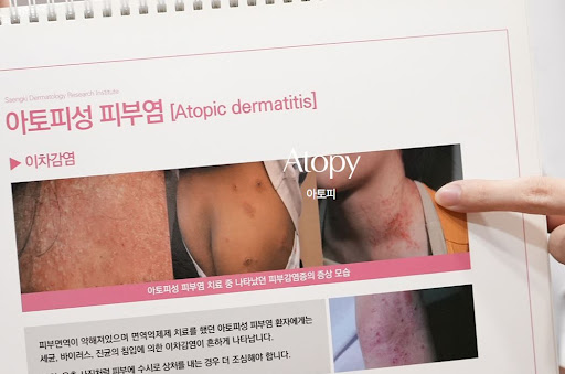 생기한의원으로 알아보는 아토피 호전과 악화 반복 이유